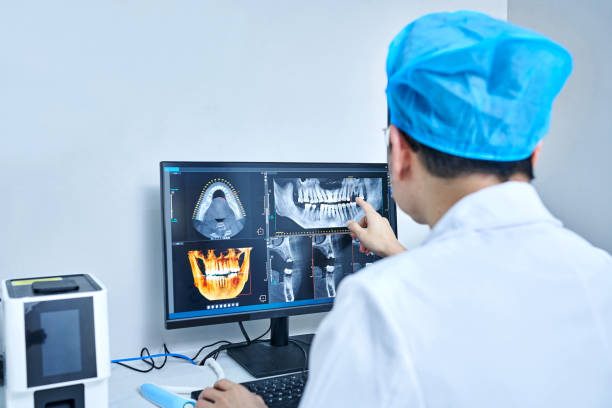 Best Broken or Chipped Tooth Repair in Berkeley, CA